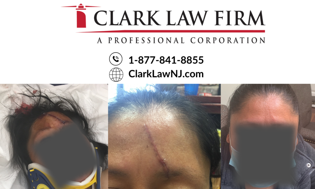 New Jersey Car Wreck Lawyer and Law Firm: Clark Law Firm P.C.